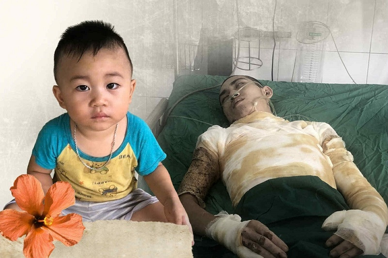 Bỏng điện toàn thân, người cha trẻ cần giúp đỡ để vượt qua cửa tử