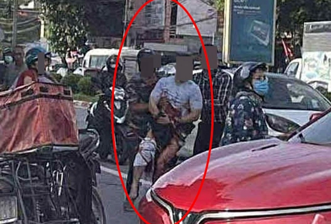 Tiktoker có tiếng ở Thái Nguyên bị chém đứt bàn tay trên đường