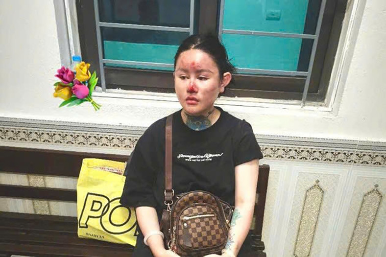 Tạm giữ hình sự Ngân 'Baby'