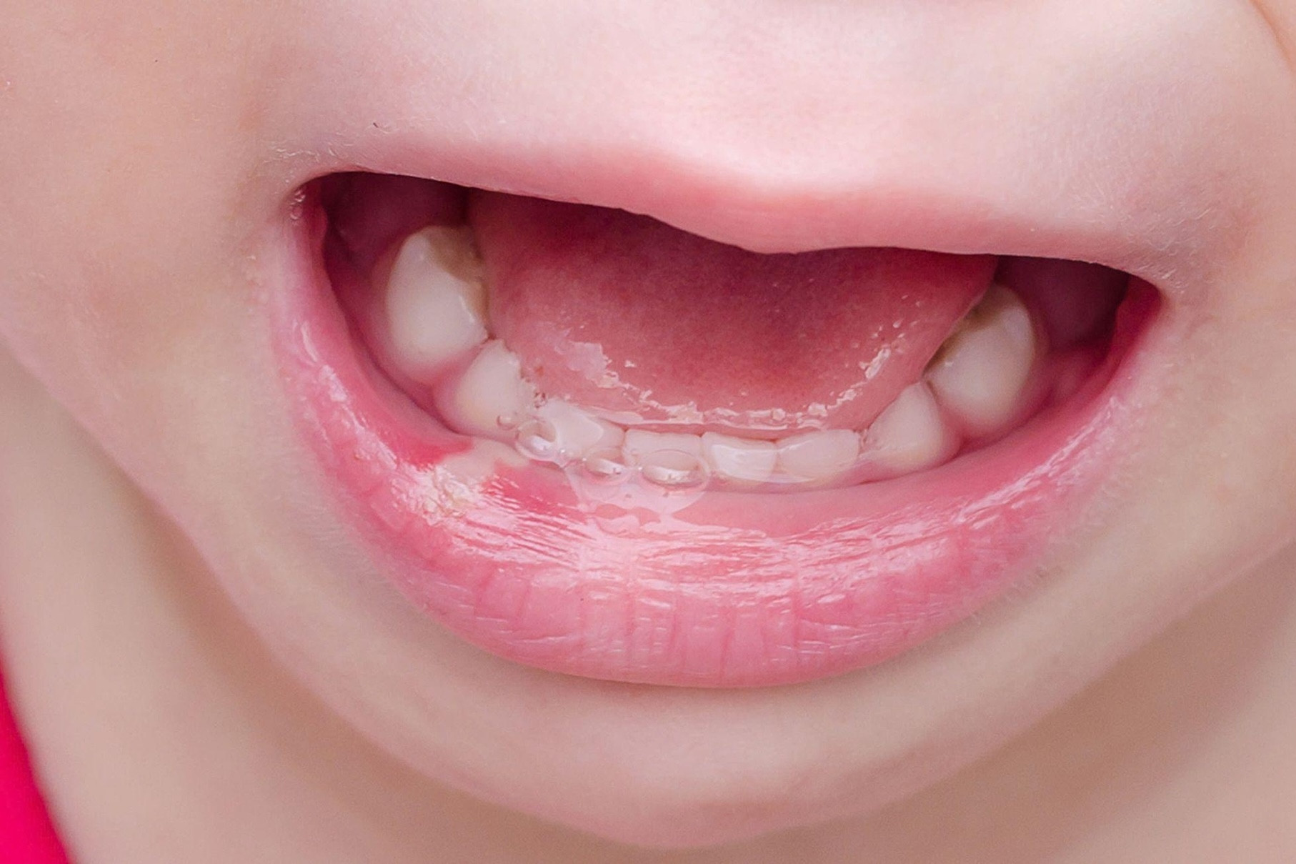 Tập đánh răng từ sớm giúp bé có hàm răng chắc khỏe lâu dài