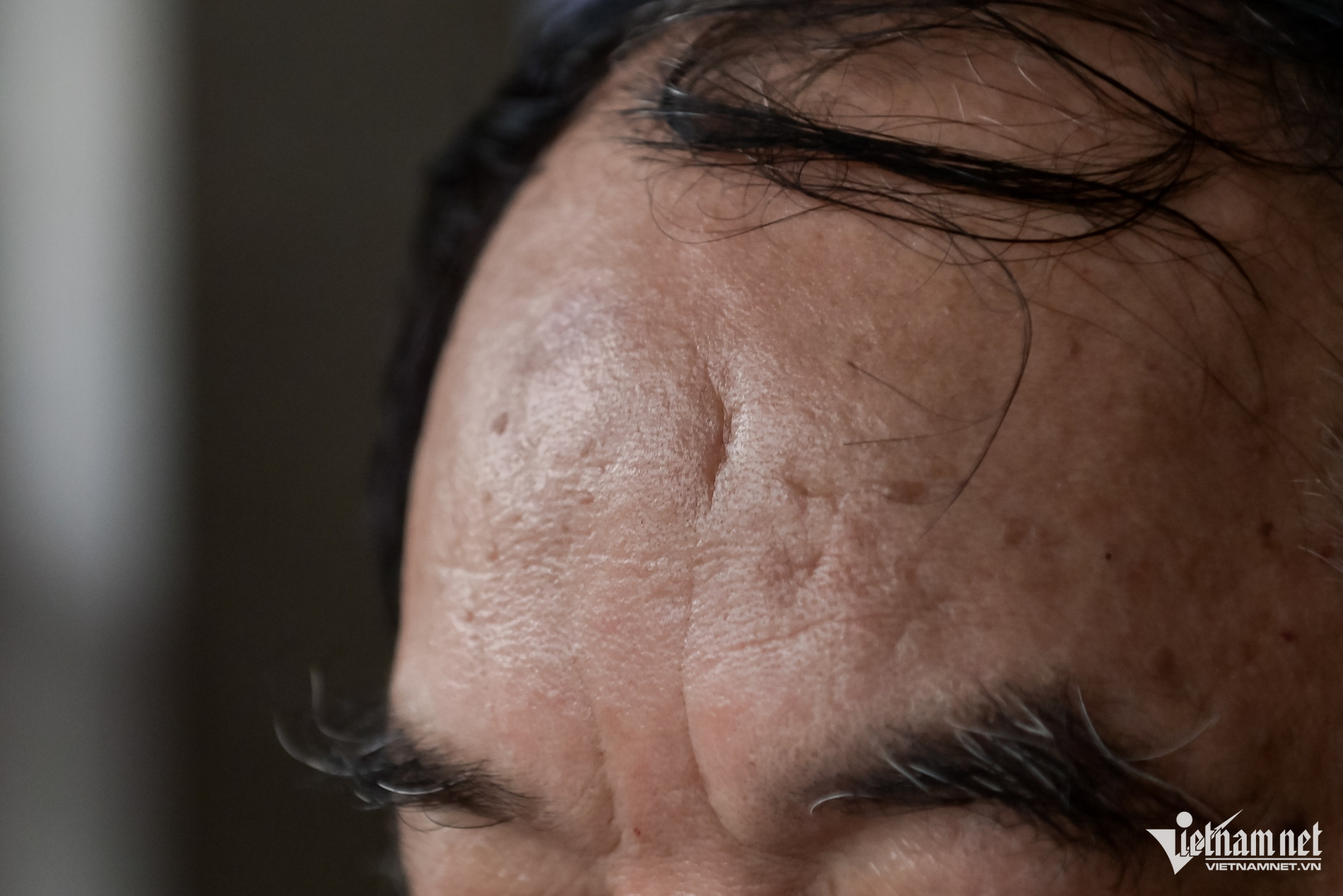 W-Thương Binh_21.jpg