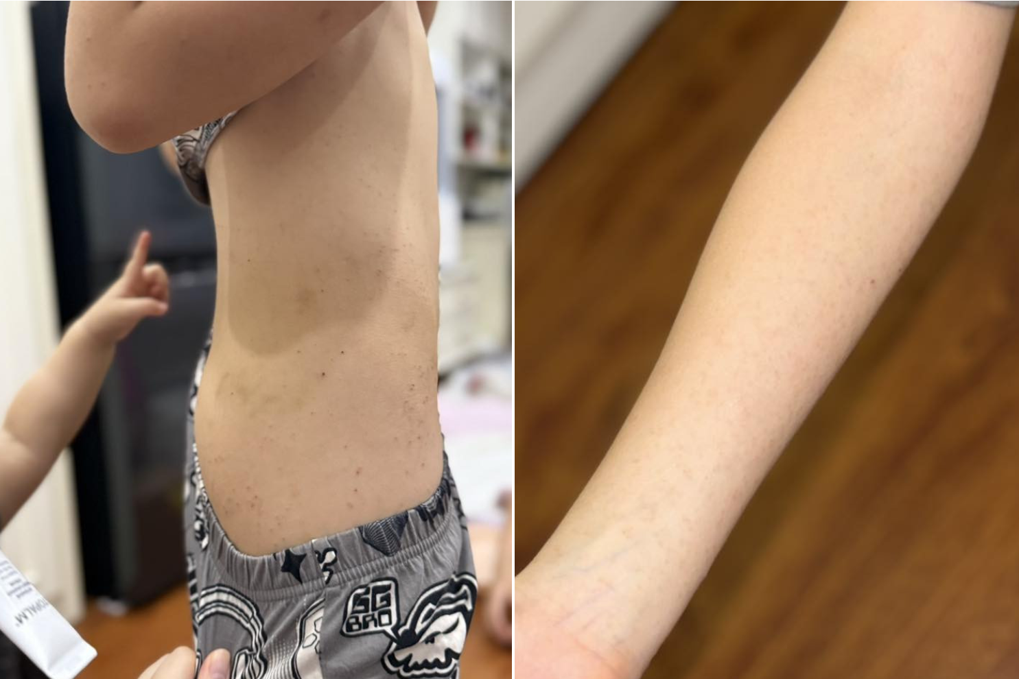 Chi gần 10 triệu đồng cho con đi trại hè 8 ngày, mẹ ở Hà Nội bức xúc khi đón con