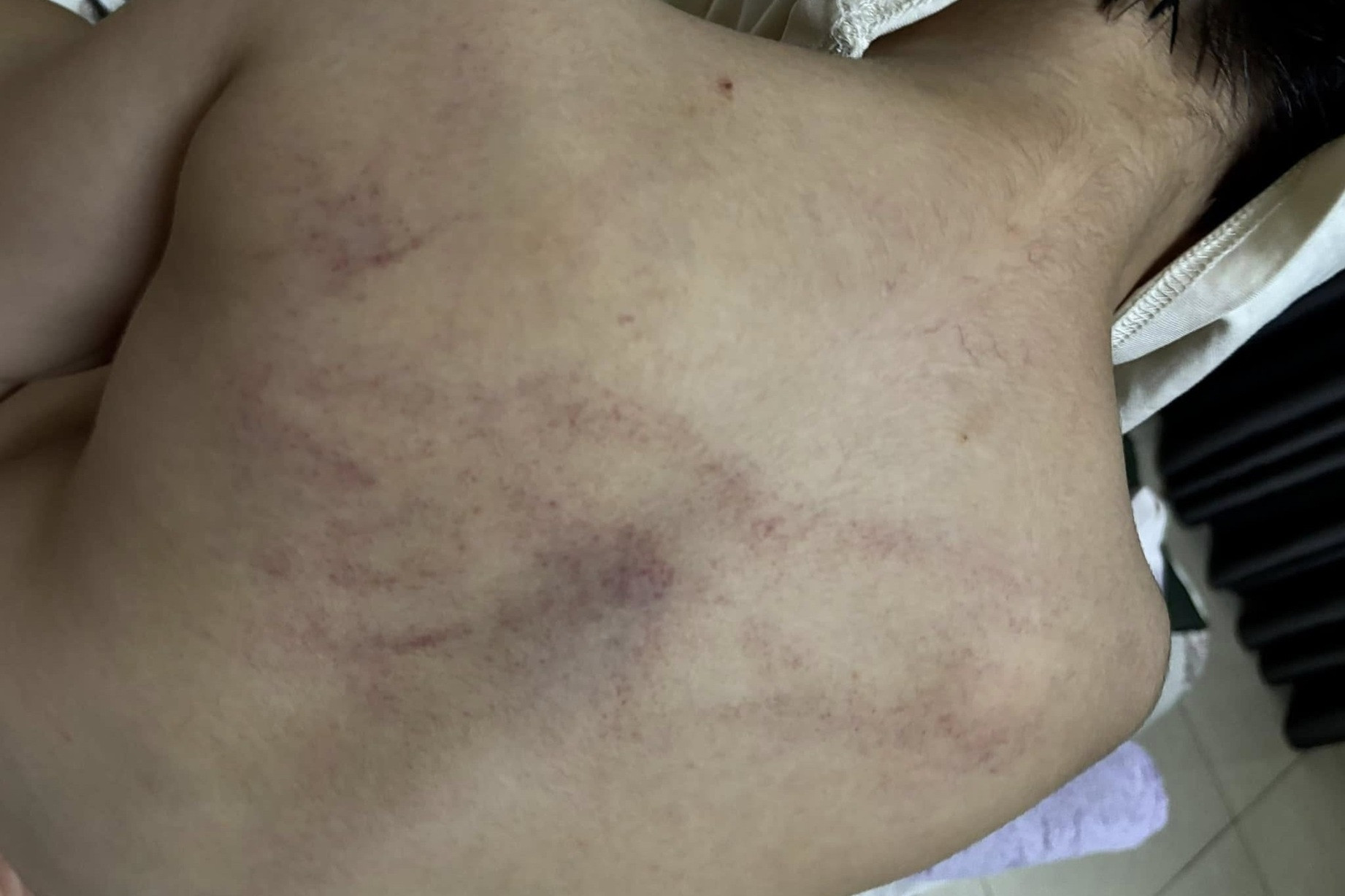 Sở GD-ĐT Hà Nội yêu cầu khẩn trương xác minh việc trẻ nghi bị giáo viên bạo hành