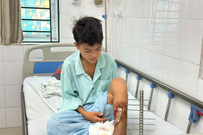 Được bạn đọc giúp đỡ, gia đình em Ly Văn Cho ở Tuyên Quang xin dừng nhận hỗ trợ
