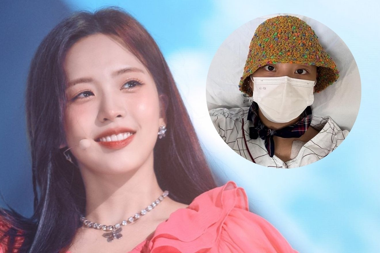 Nữ ca sĩ bị ung thư máu cạo trọc đầu sau 2 lần hóa trị