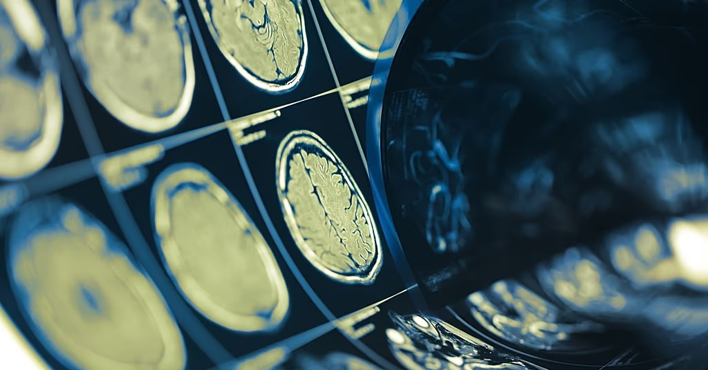 Chip não đọc ý nghĩ chính xác tới 74%: Phước lành hay ác mộng?