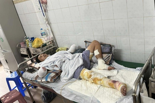 Mẹ nghèo xin cứu con trai bị điện giật cắt cụt 2 tay, con gái bệnh tim