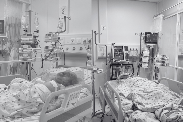 Bản tin trưa 21/8: Cấp cứu hai trẻ bị cha phóng hỏa lúc sáng sớm