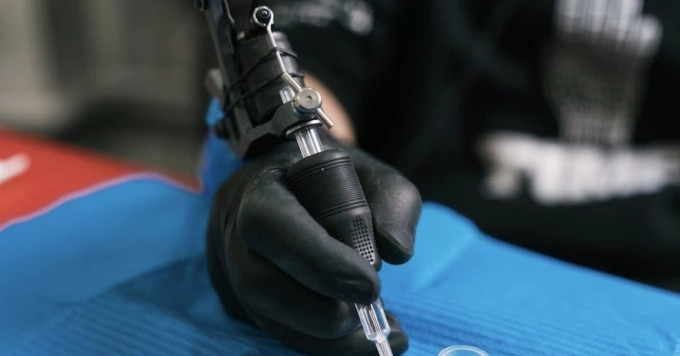 Người phụ nữ gặp biến cố khi xăm hồng ngực