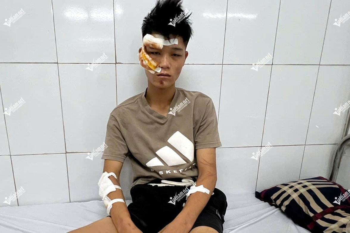 Bản tin trưa 23/8: Lời khai đối tượng 'thông chốt', tông Đại úy Lê Đình Công