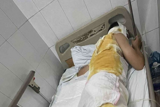 Xót xa người chồng trẻ bị bỏng điện toàn thân, vợ ôm con nhỏ cầu cứu cộng đồng