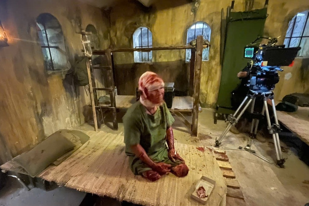 Xót xa câu hỏi của diễn viên 'Mưa đỏ': 'Muốn cụt tay, cụt chân hay bị mù?'