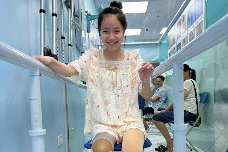 Em Nguyễn Minh Châu bị tai nạn được lắp chân giả