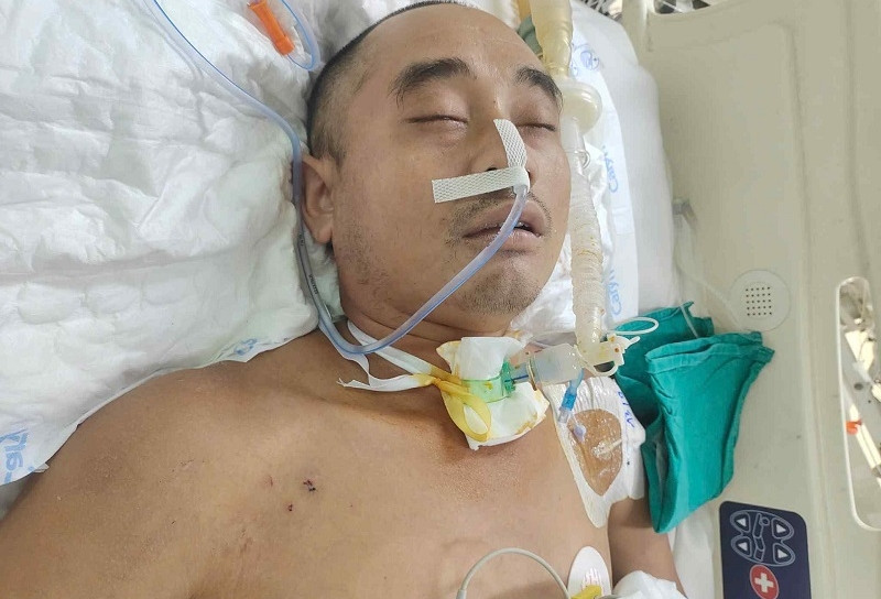 Người đàn ông nguy kịch sau cơn bạo bệnh cần 50 triệu đồng để cứu tính mạng