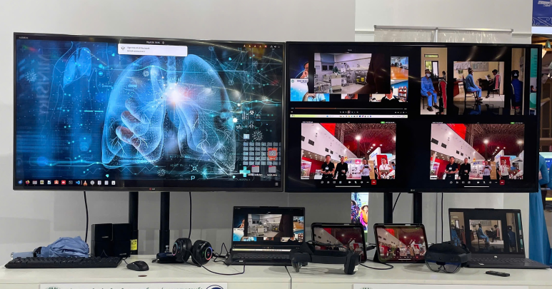 Bệnh viện Bạch Mai giới thiệu AI phát hiện ung thư phổi từ giai đoạn siêu sớm