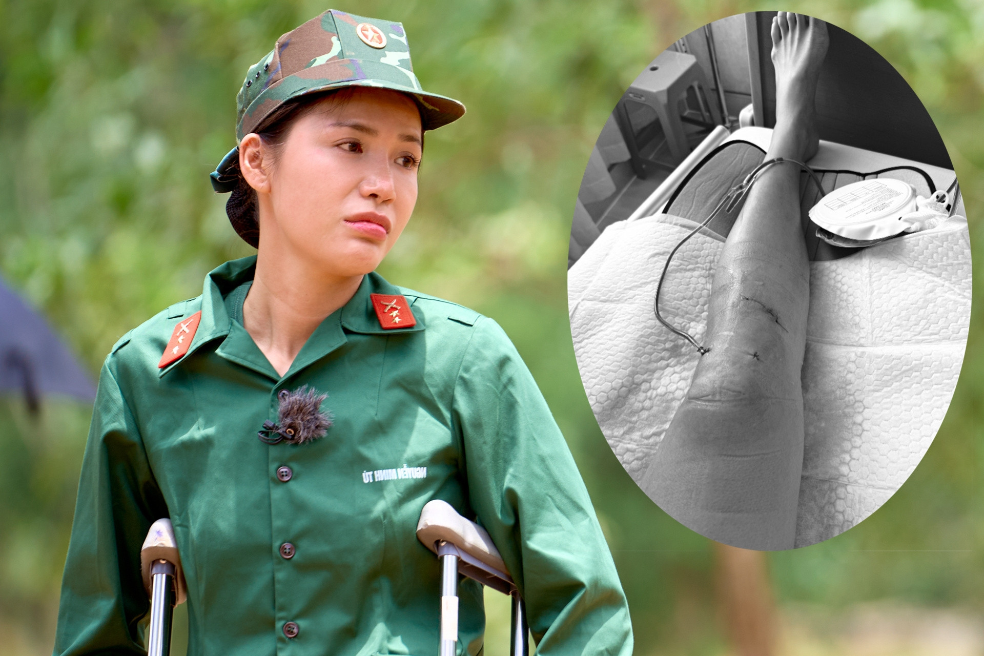 Siêu mẫu Minh Tú chấn thương nghiêm trọng, bác sĩ lên tiếng cảnh báo