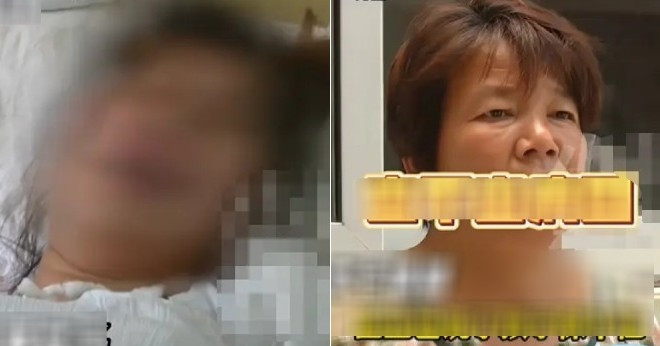 Con gái mang thai mắc bệnh nặng, mẹ đẻ làm ngơ gây phẫn nộ