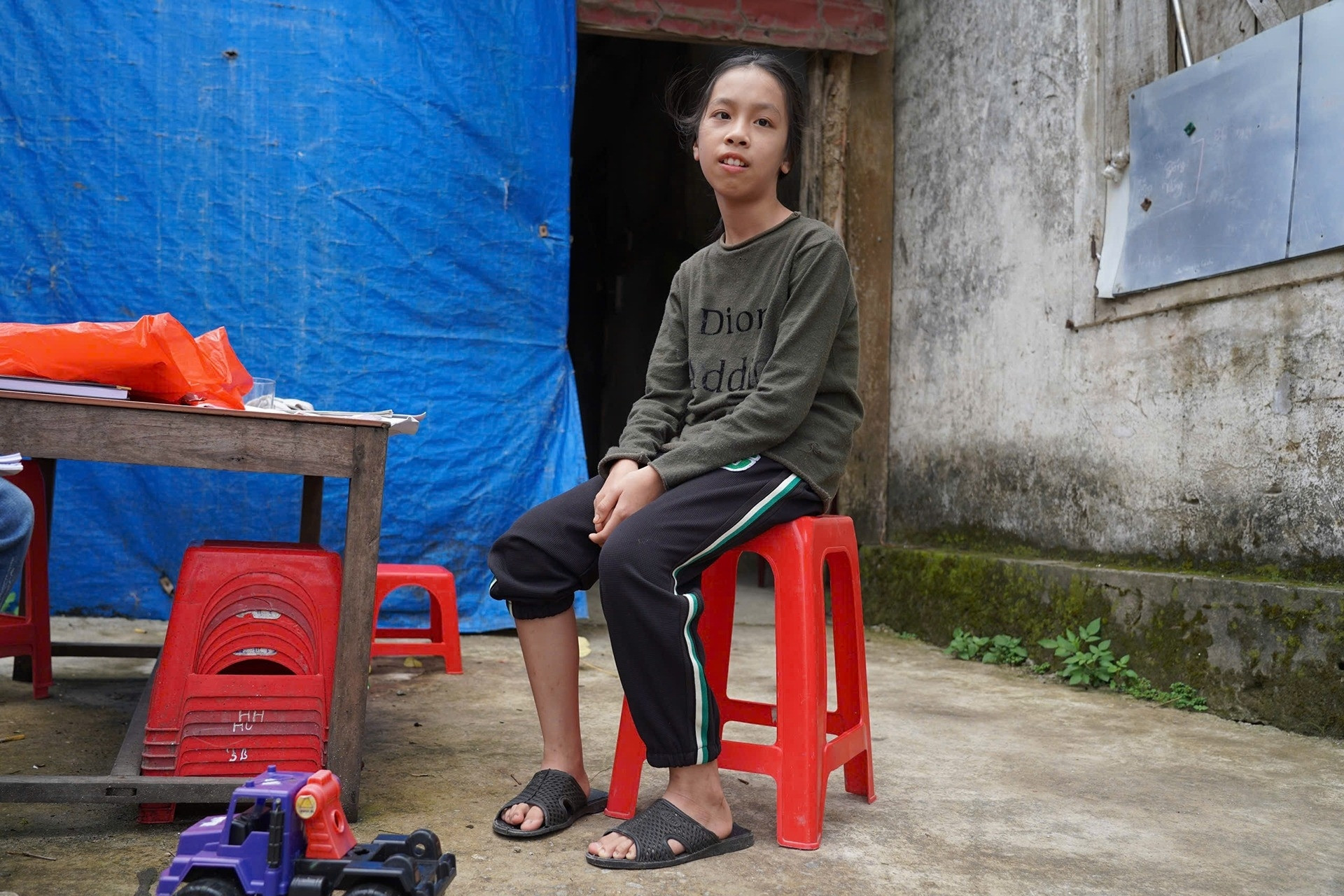 Bố mẹ nghèo bất lực không có tiền phẫu thuật cứu con gái bị dị dạng mạch máu não
