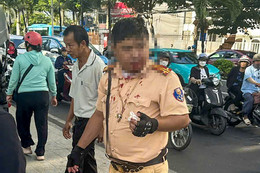 Trung tá CSGT ở Nha Trang bị người nước ngoài đấm vào mặt khi đang làm nhiệm vụ