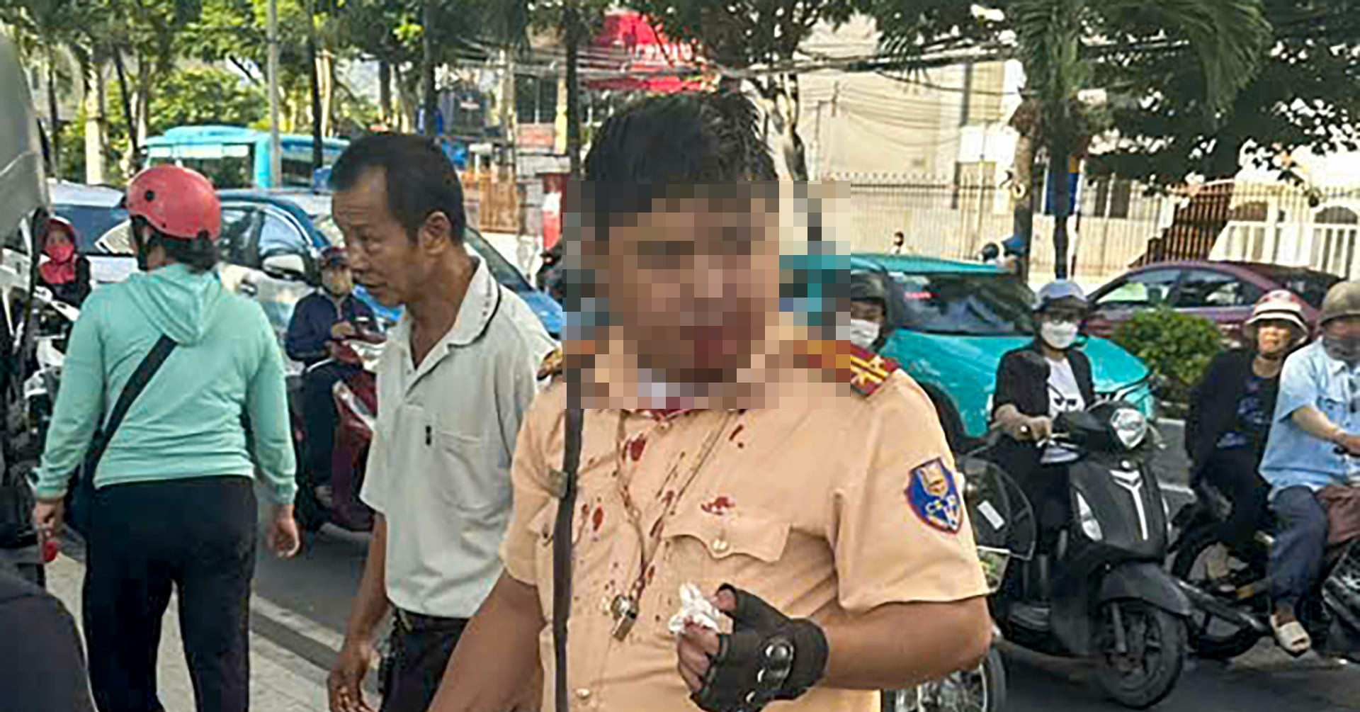 Trung tá CSGT ở Nha Trang bị người nước ngoài đ...