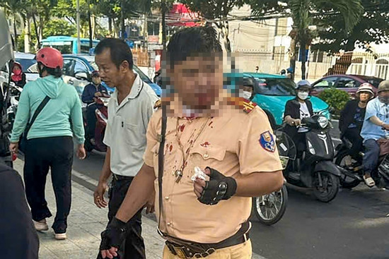Bản tin cuối ngày 7/8: Trung tá CSGT ở Nha Trang bị người nước ngoài đấm vào mặt