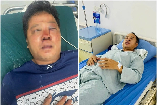 Bản tin chiều 10/9: Danh tính đối tượng hành hung dã man 2 anh em làm việc tốt