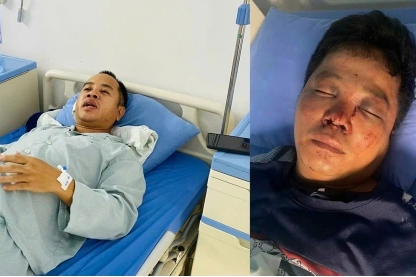 Bản tin sáng 10/9: Giúp người rồi bị đánh: Lời cảnh tỉnh từ vụ việc ở Bắc Ninh