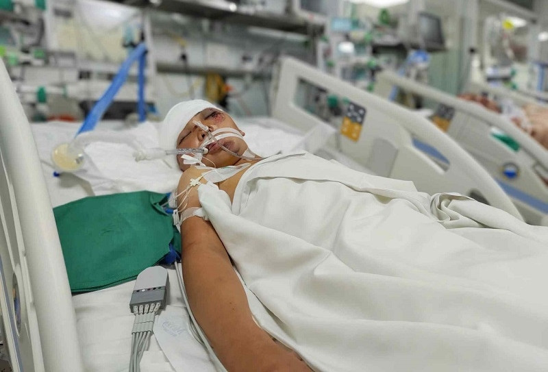 Bị tai nạn nguy kịch, cậu bé nghèo dân tộc Mông cần một phép màu để được sống