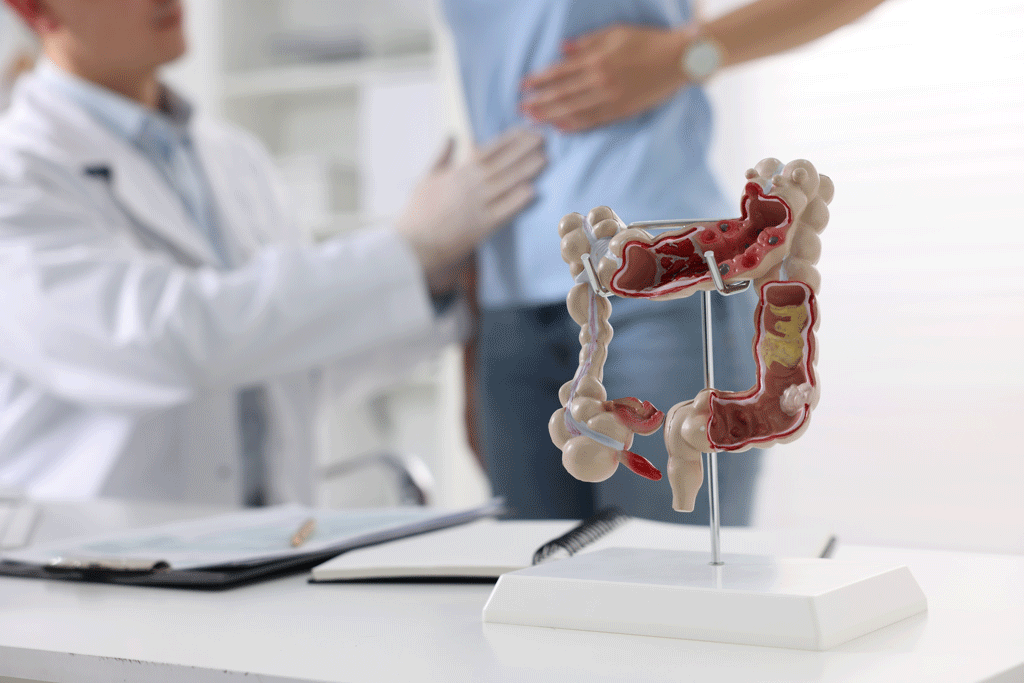 Phát hiện mắc ung thư đại tràng từ sắc mặt xấu