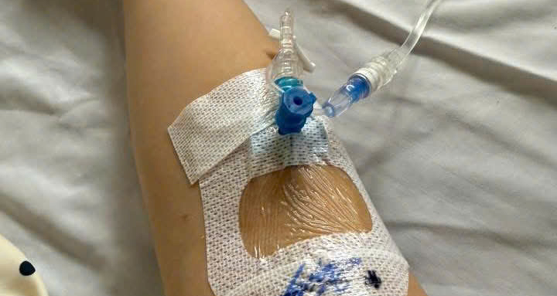 Hàng loạt người dân một chung cư ở TPHCM bị sốt, đau bụng sau khi ăn bánh mì