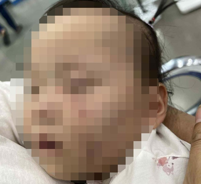 Chau Be O Bac Ninh.jpg