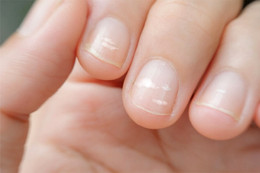 Trên tay xuất hiện 5 thay đổi, coi chừng là tín hiệu ung thư