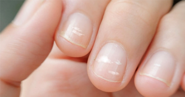 Trên tay xuất hiện 5 thay đổi, coi chừng là tín hiệu ung thư