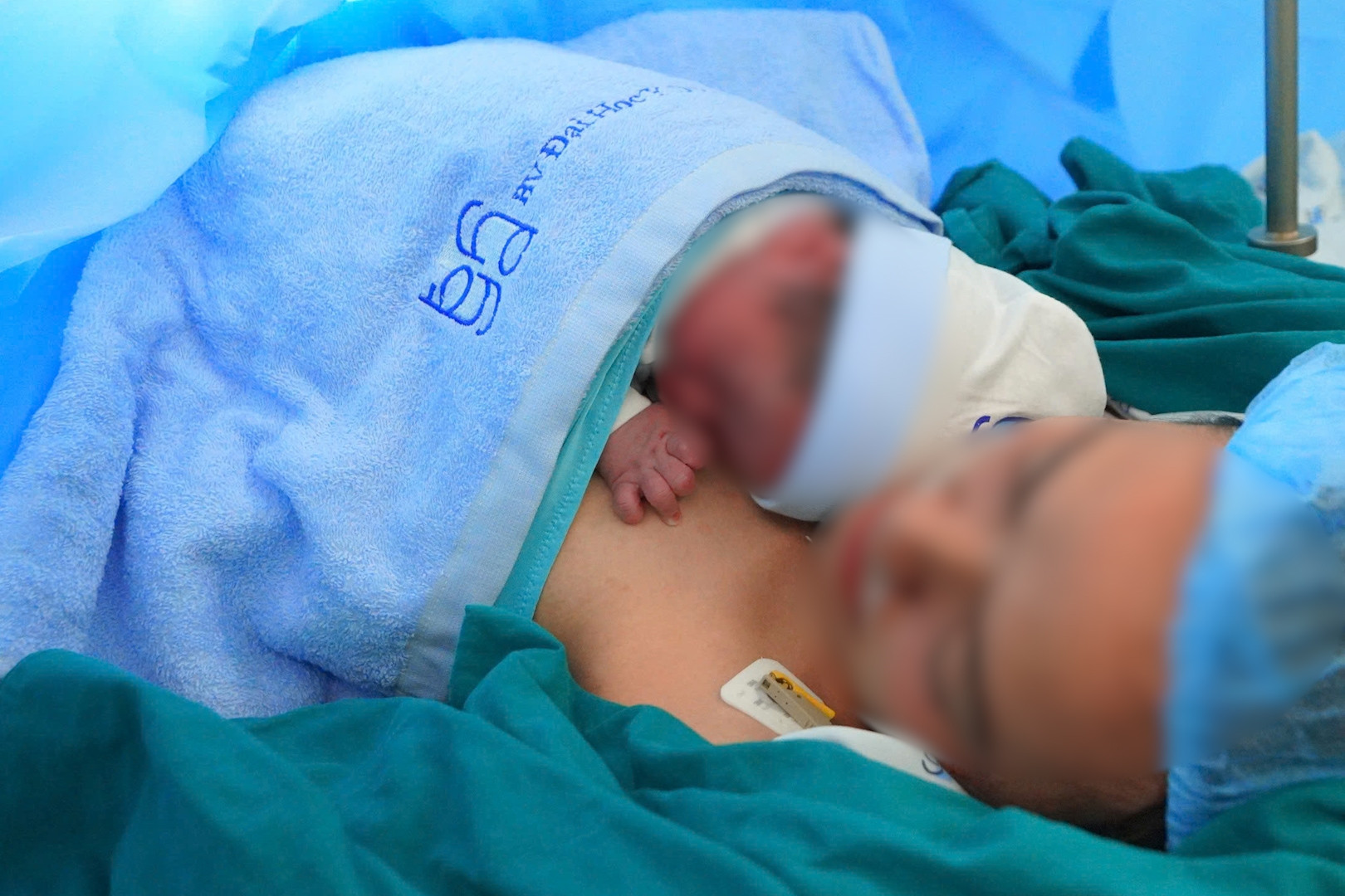 Can thiệp cứu sống thai nhi 28 tuần mắc khối u nhau thai khổng lồ