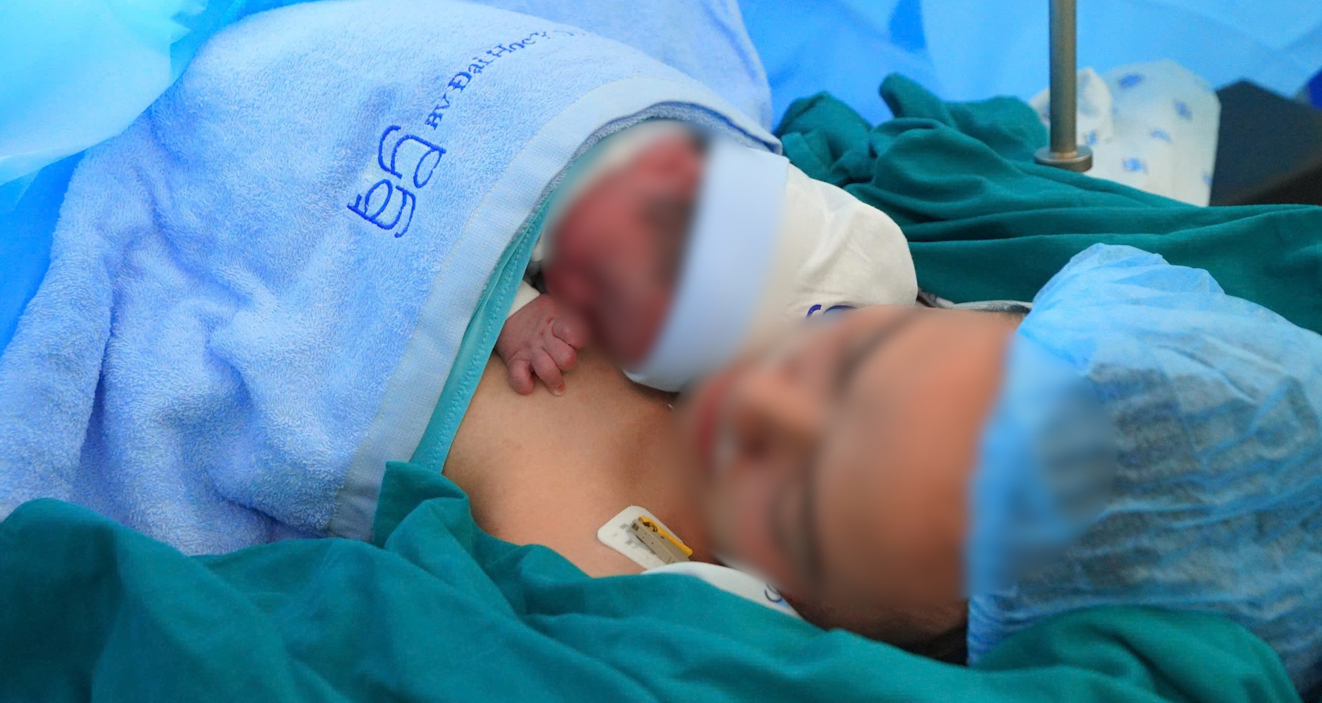 Can thiệp cứu sống thai nhi 28 tuần mắc khối u nhau thai khổng lồ