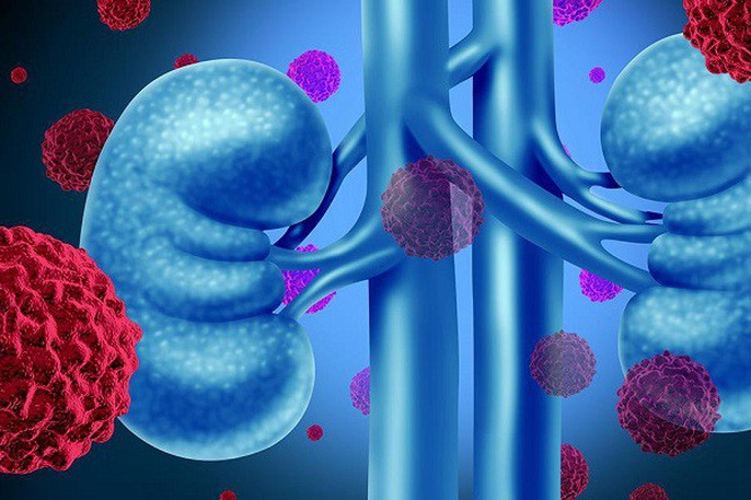 Nam sinh 15 tuổi đi khám phát hiện mang căn bệnh 3 đời liên tiếp