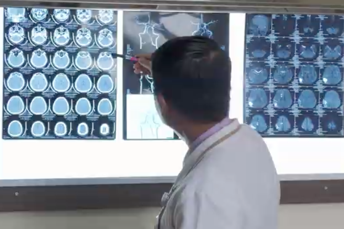 3 điều nên làm trong kỳ nghỉ lễ để phòng ngừa đột quỵ