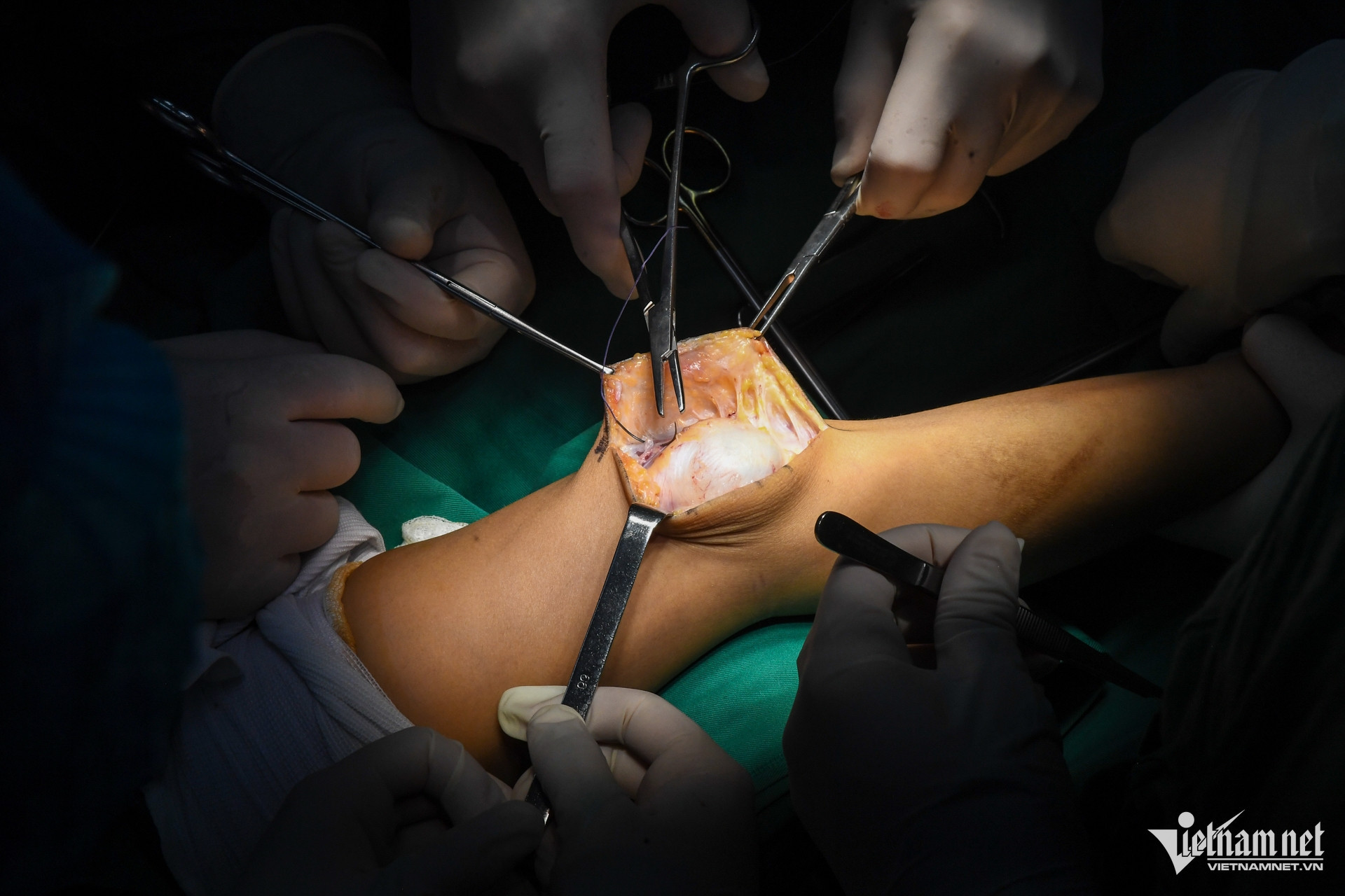 Box https://static-images.vnncdn.net/vps_images_publish/000001/000003/2026/1/1/w-phau-thuat-y-te-benh-vien-45-45194-346.jpg