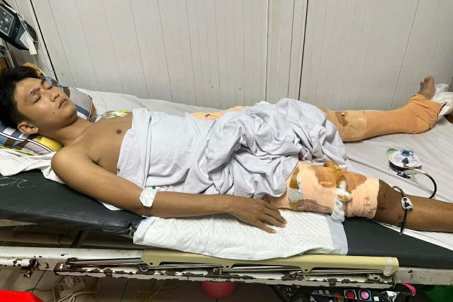 Chàng trai Hà Tĩnh nguy cơ tàn phế sau tai nạn, mẹ nghèo cầu cứu cộng đồng