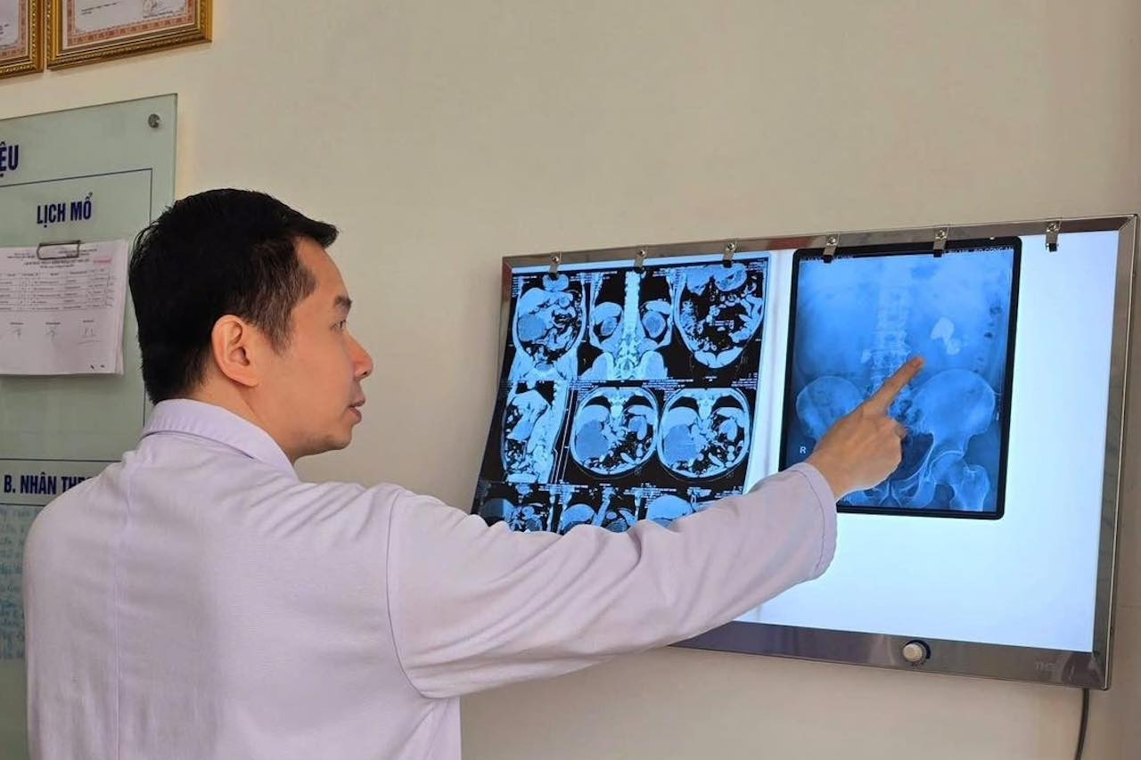 4 năm trì hoãn 'chưa đau thì không sao', người đàn ông đối diện hỏng 1 quả thận