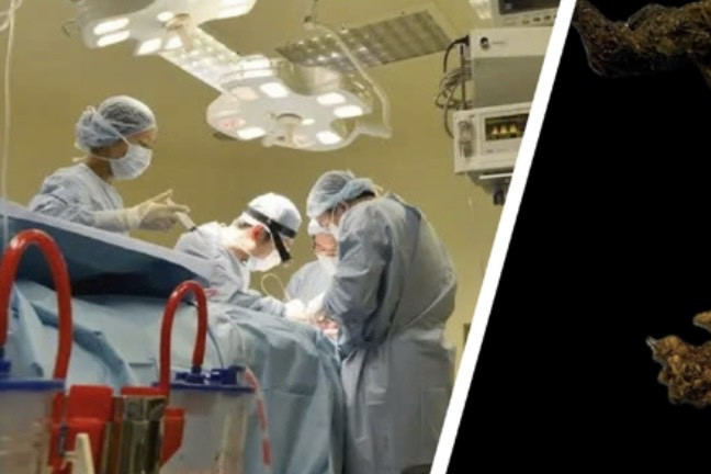 TP.HCM: Bé gái 9 tuổi bị tắc ruột do thói quen ‘ăn tóc’