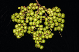 Phẫu thuật lấy sỏi thận cỡ lớn như san hô cho nữ bệnh nhân 55 tuổi Loại quả dân dã được dùng hỗ trợ chữa sỏi thận