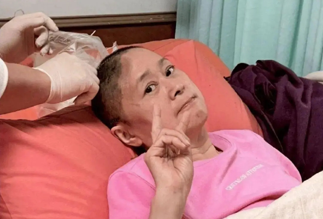 Diễn viên Vương Nguyệt 'Vườn sao băng' ngã chấn thương, mất một phần hộp sọ