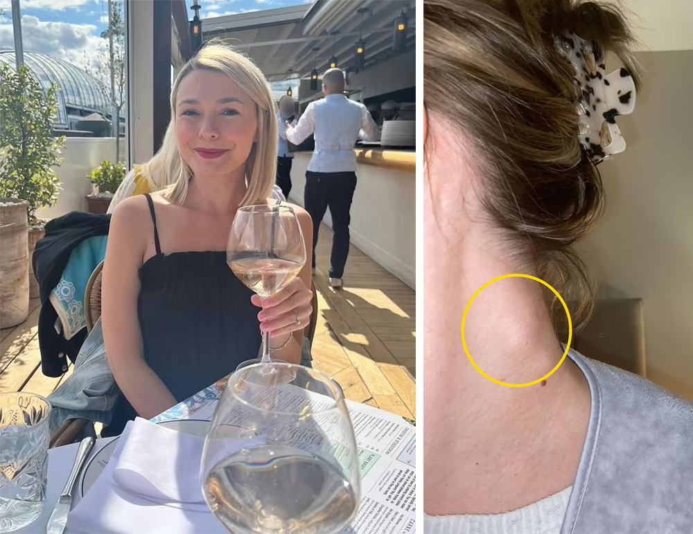 Hollie ung thu uong ruou.jpg