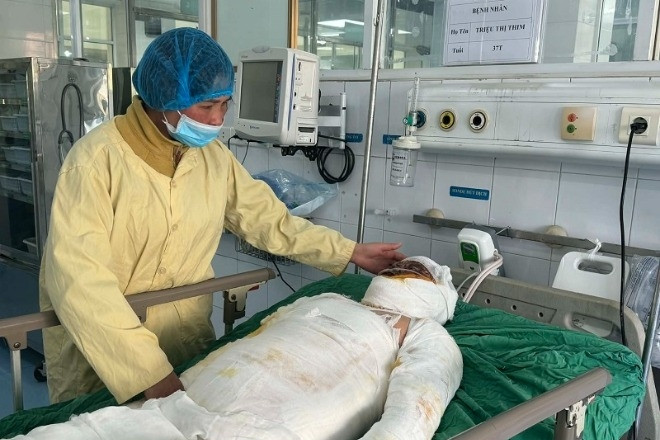 Người đàn ông nghèo vét bơ thóc, bán đàn gà con cứu vợ bỏng nặng