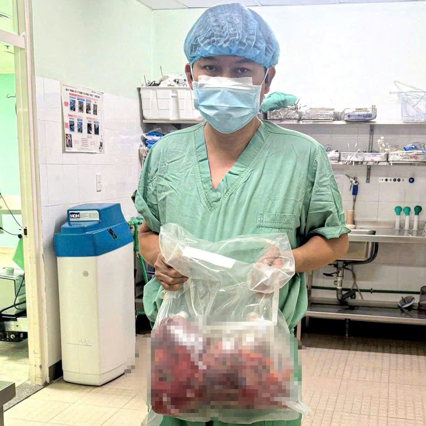 Lần đầu tiên thay mới, cắt bỏ 2 quả thận đa nang khổng lồ 10kg than da nang.png