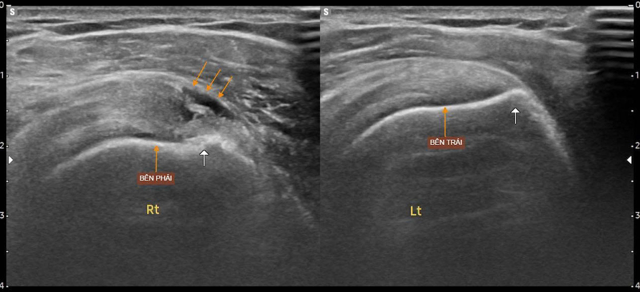 7a25ab70 4ccc 40a2 90e4 4c3441214427.jpeg