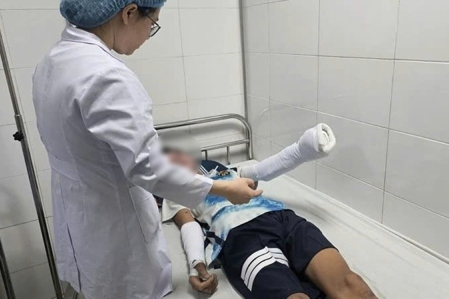 Làm pháo tự chế theo trên mạng, nam sinh ở Thanh Hóa bị nổ dập nát bàn tay