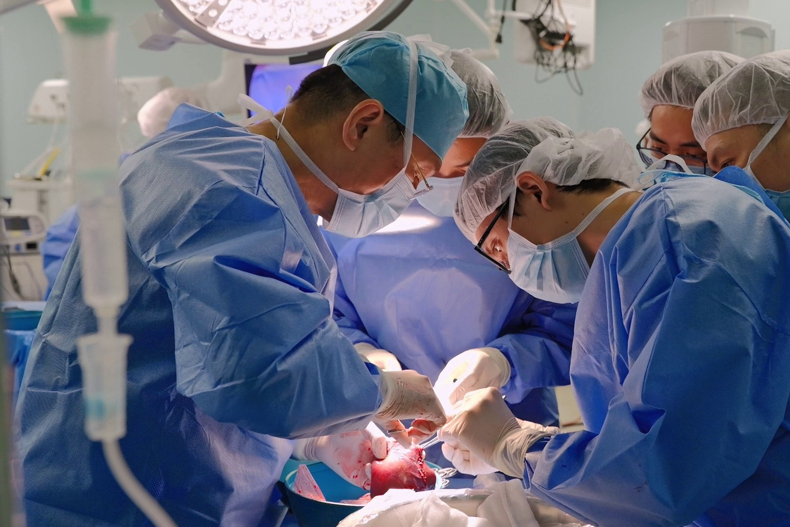 Ghép gan cho bé gái chưa đầy 1 tuổi nặng chỉ 5,3 kg tại Vinmec Times City