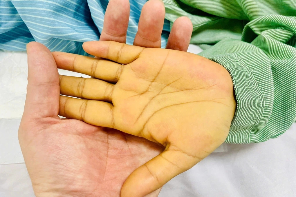 2 vị trí có màu vàng cảnh báo nguy hiểm không nên bỏ qua